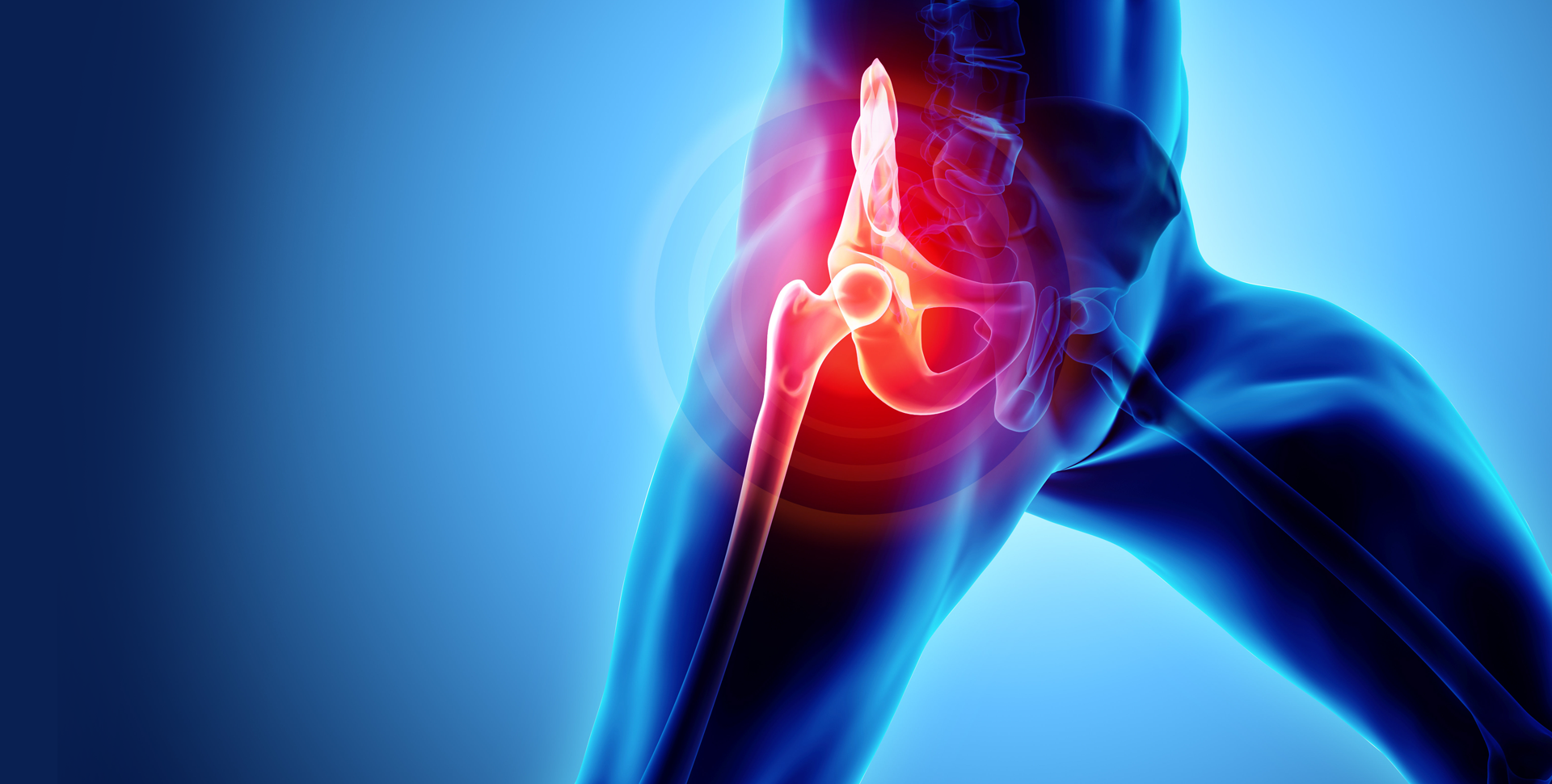 AVN treatment in Mandla