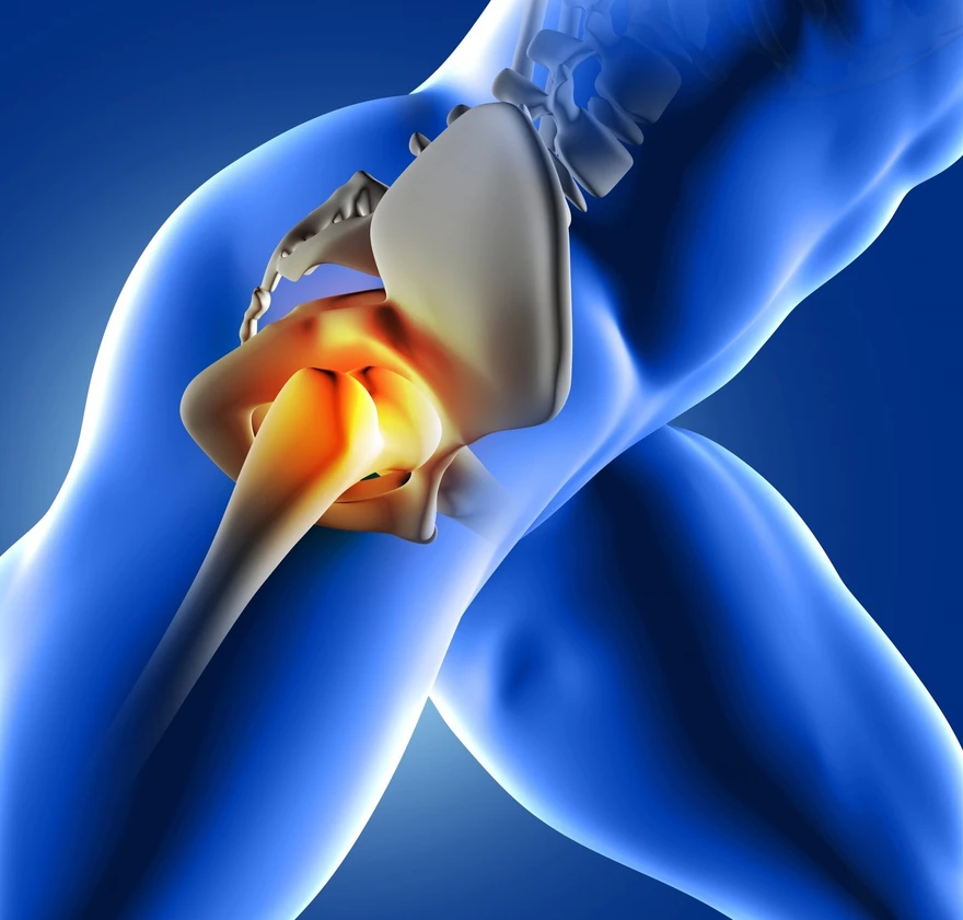 AVN treatment in Rewa