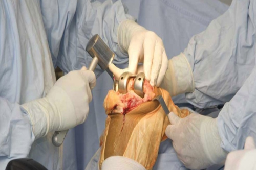 Acl ligament treatment in Seoni