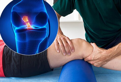 Acl ligament treatment in Shahdol