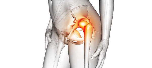 Hip replacement in Bhopal