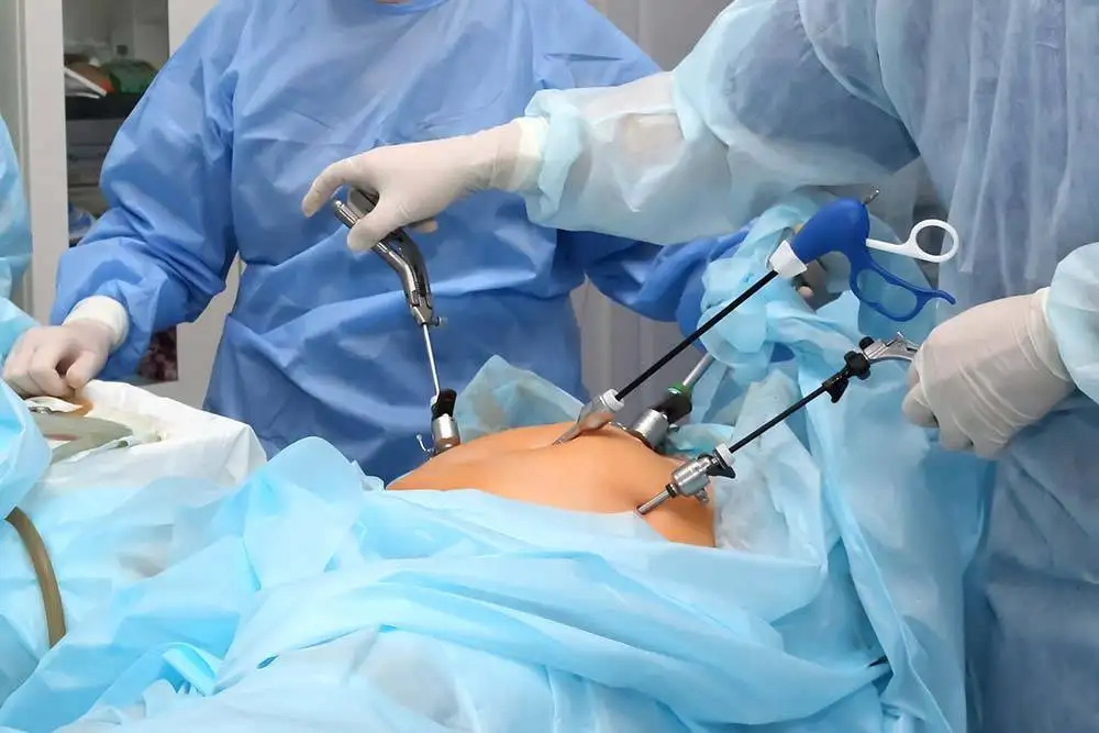 Laparoscopy Surgery